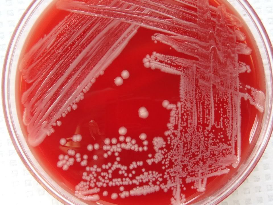 Moraxella Catarrhalis Pictures, Images & Photos Photobucket